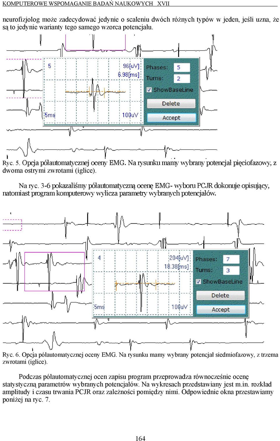 3-6 pokazaliśmy półautomatyczną ocenę EMG- wyboru PCJR dokonuje opisujący, natomiast program komputerowy wylicza parametry wybranych potencjałów. Ryc. 6. Opcja półautomatycznej oceny EMG.