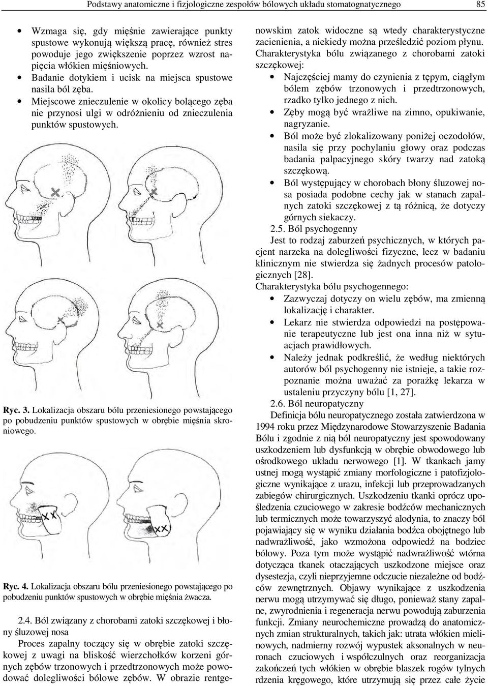 Miejscowe znieczulenie w okolicy bolącego zęba nie przynosi ulgi w odróżnieniu od znieczulenia punktów spustowych. Ryc. 3.