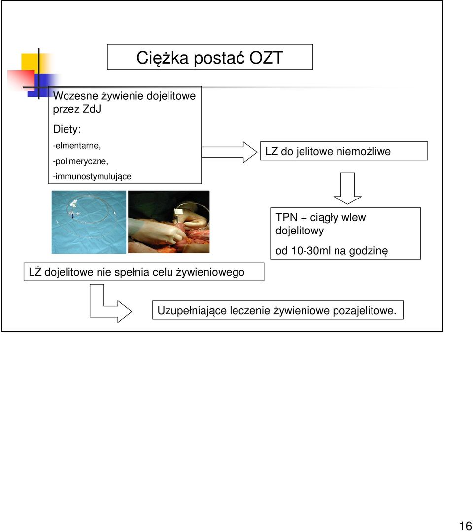 niemożliwe TPN + ciągły wlew dojelitowy od 10-30ml na godzinę LŻ