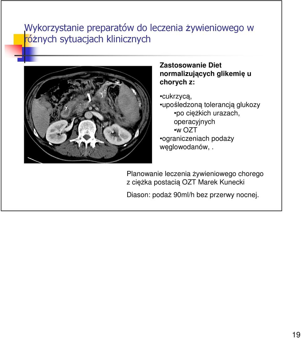 glukozy po ciężkich urazach, operacyjnych w OZT ograniczeniach podaży węglowodanów,.