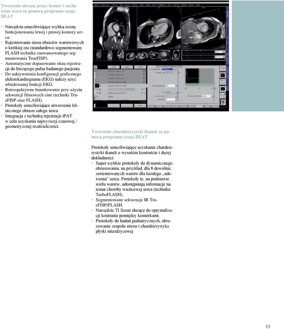 Do uaktywnienia konfiguracji graficznego elektrokardiogramu (EKG) należy użyć wbudowanej funkcji EKG. Retrospektywne bramkowanie przy użyciu sekwencji filmowych cine (techniki TrueFISP oraz FLASH).