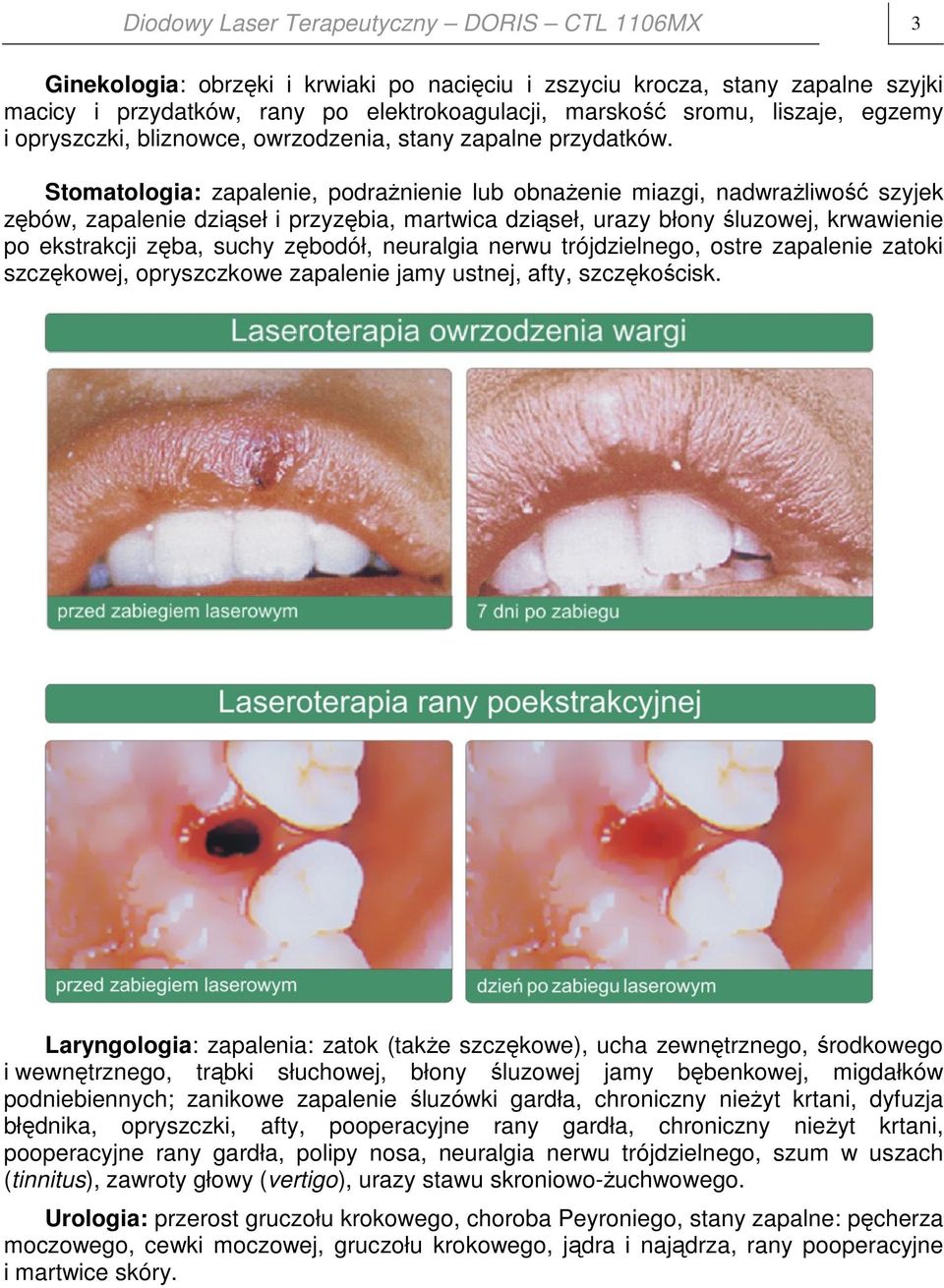 Stomatologia: zapalenie, podrażnienie lub obnażenie miazgi, nadwrażliwość szyjek zębów, zapalenie dziąseł i przyzębia, martwica dziąseł, urazy błony śluzowej, krwawienie po ekstrakcji zęba, suchy