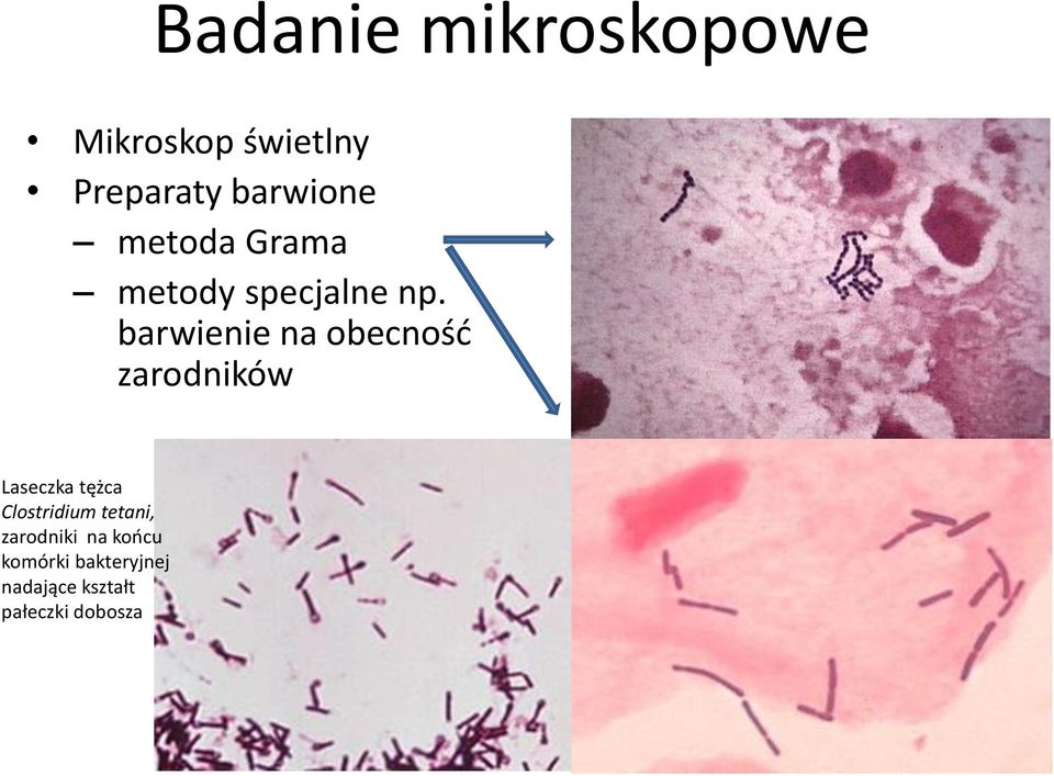 barwienie na obecnośd zarodników Laseczka tężca