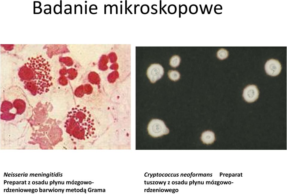 barwiony metodą Grama Cryptococcus neoformans