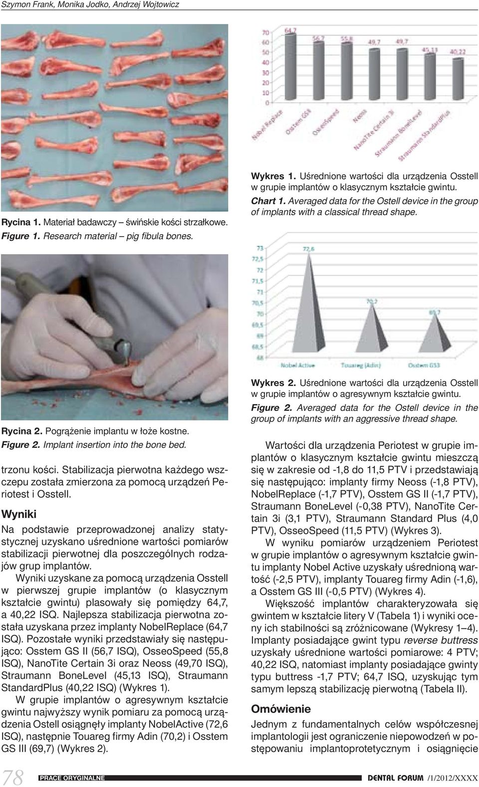 Rycina 2. Pogrążenie implantu w łoże kostne. Figure 2. Implant insertion into the bone bed. trzonu kości.