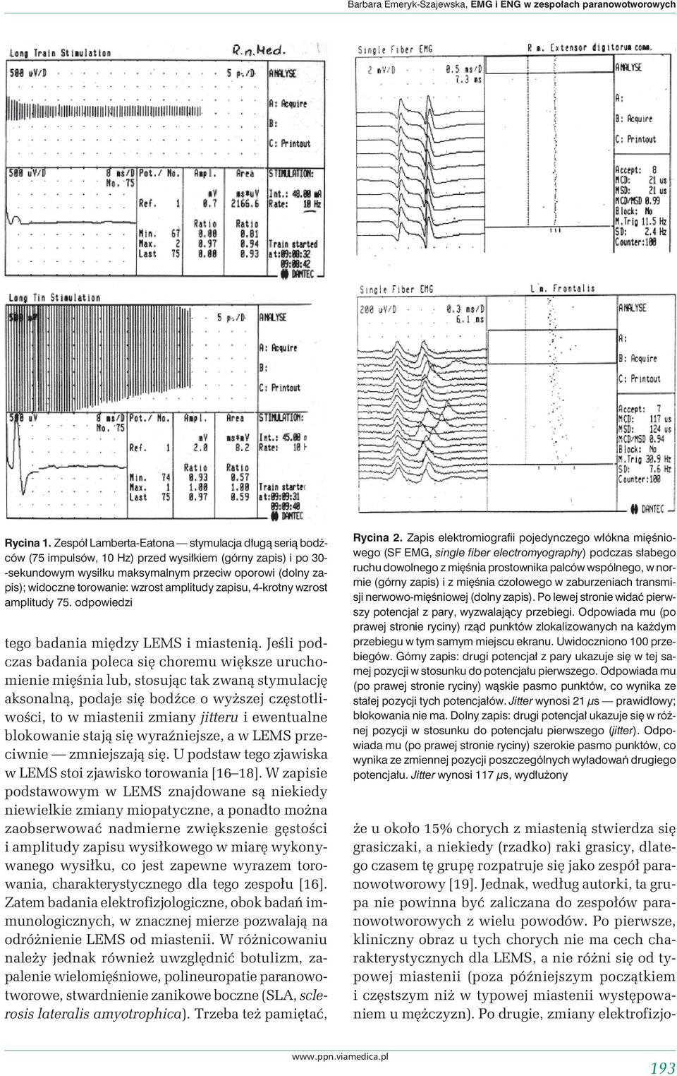 wzrost amplitudy zapisu, 4-krotny wzrost amplitudy 75. odpowiedzi tego badania między LEMS i miastenią.