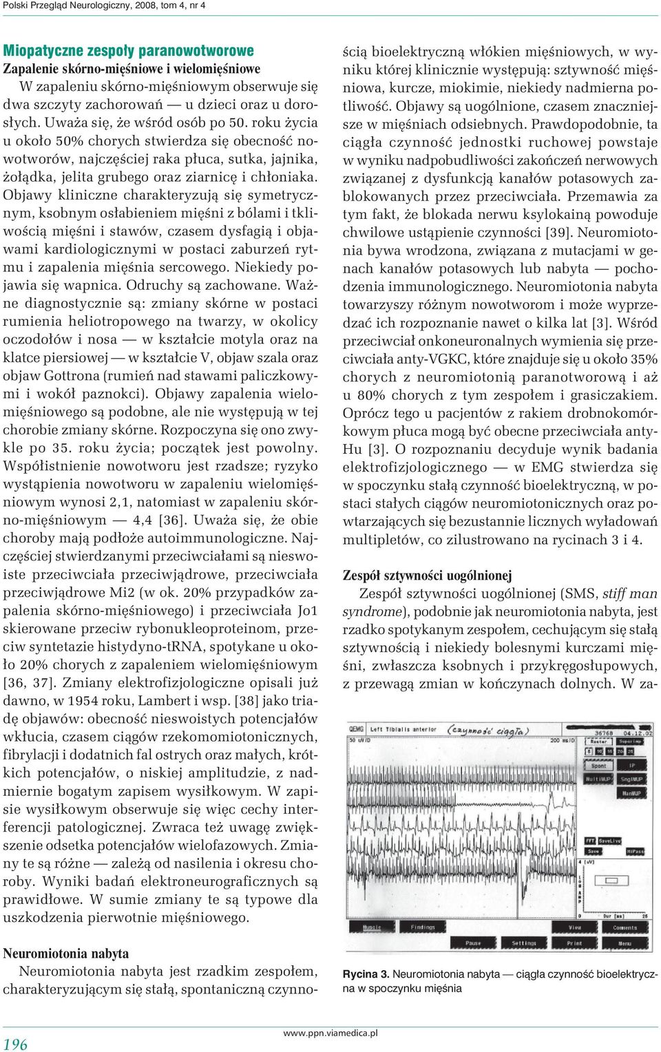 roku życia u około 50% chorych stwierdza się obecność nowotworów, najczęściej raka płuca, sutka, jajnika, żołądka, jelita grubego oraz ziarnicę i chłoniaka.