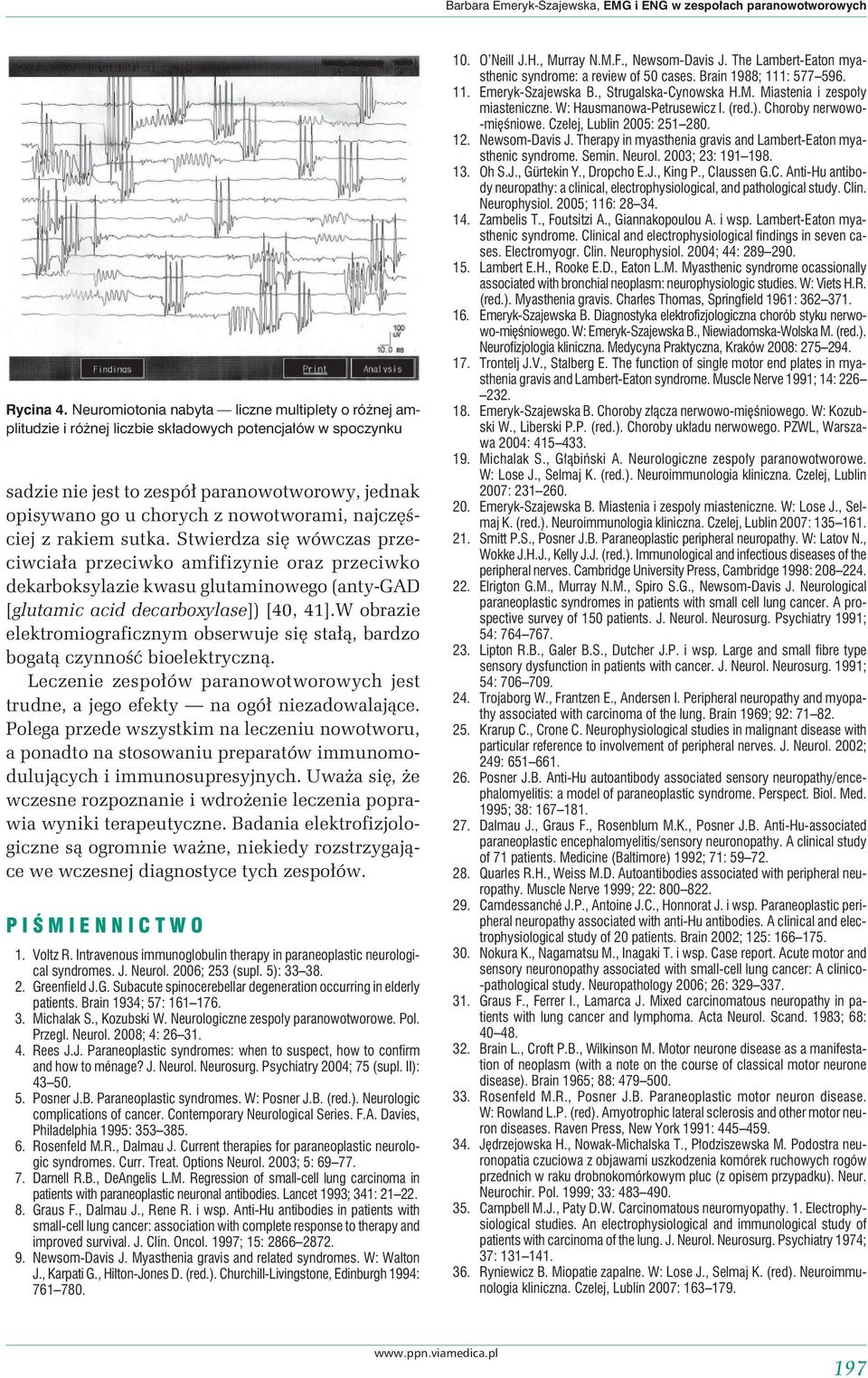 najczęściej z rakiem sutka. Stwierdza się wówczas przeciwciała przeciwko amfifizynie oraz przeciwko dekarboksylazie kwasu glutaminowego (anty-gad [glutamic acid decarboxylase]) [40, 41].