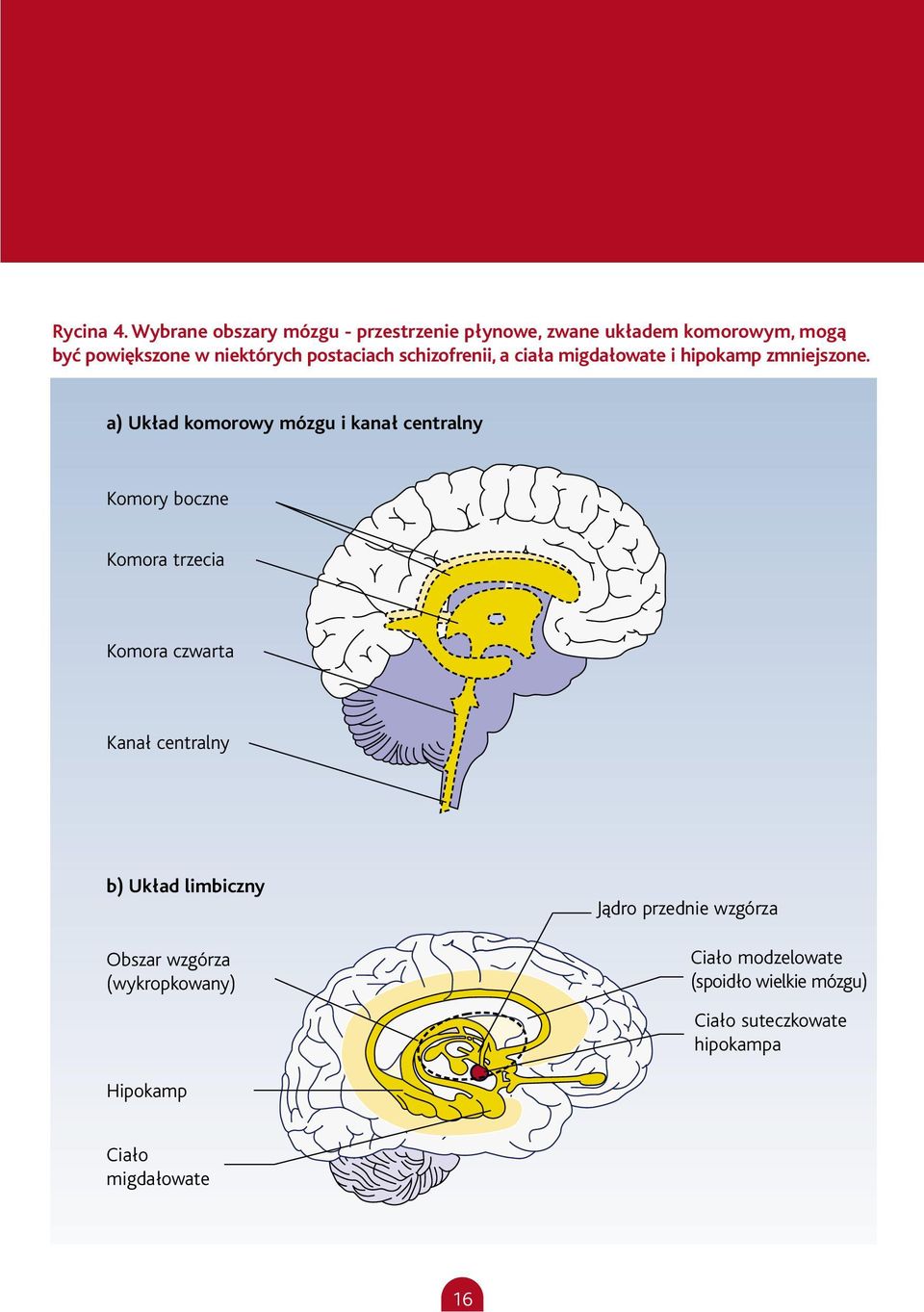 postaciach schizofrenii, a ciała migdałowate i hipokamp zmniejszone.
