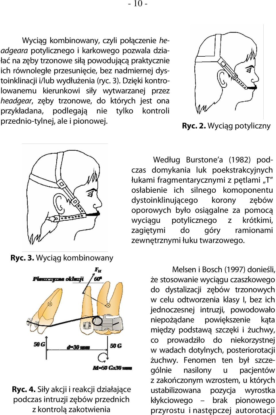 Dzięki kontrolowanemu kierunkowi siły wytwarzanej przez headgear, zęby trzonowe, do których jest ona przykładana, podlegają nie tylko kontroli przednio-tylnej, ale i pionowej. Ryc. 2.