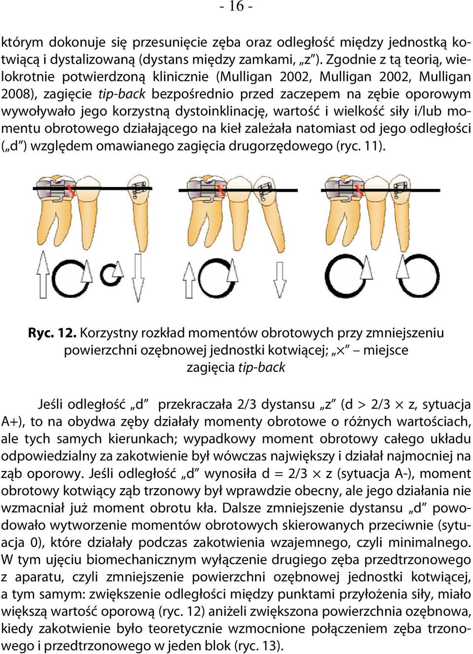 dystoinklinację, wartość i wielkość siły i/lub momentu obrotowego działającego na kieł zależała natomiast od jego odległości ( d ) względem omawianego zagięcia drugorzędowego (ryc. 11). Ryc. 12.