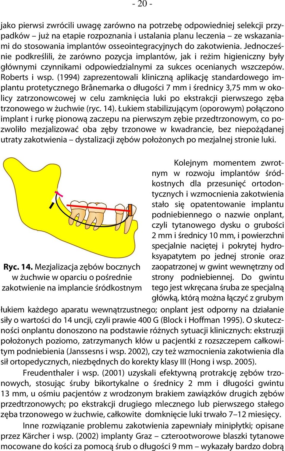 (1994) zaprezentowali kliniczną aplikację standardowego implantu protetycznego Brånemarka o długości 7 mm i średnicy 3,75 mm w okolicy zatrzonowcowej w celu zamknięcia luki po ekstrakcji pierwszego