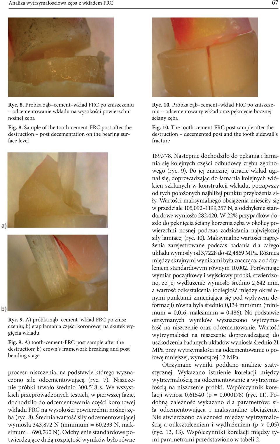 A) tooth-cement-frc post sample after the destruction; b) crown s framework breaking and post bending stage procesu niszczenia, na podstawie którego wyznaczono siłę odcementowującą (ryc. 7).