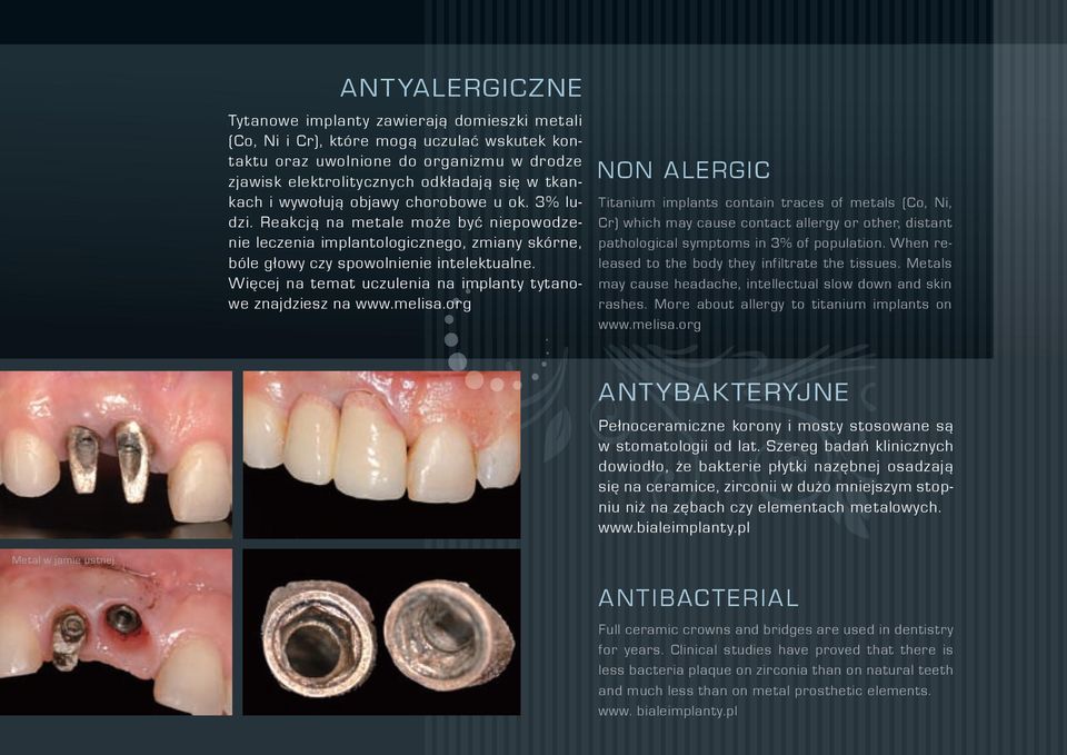 Więcej na temat uczulenia na implanty tytanowe znajdziesz na www.melisa.