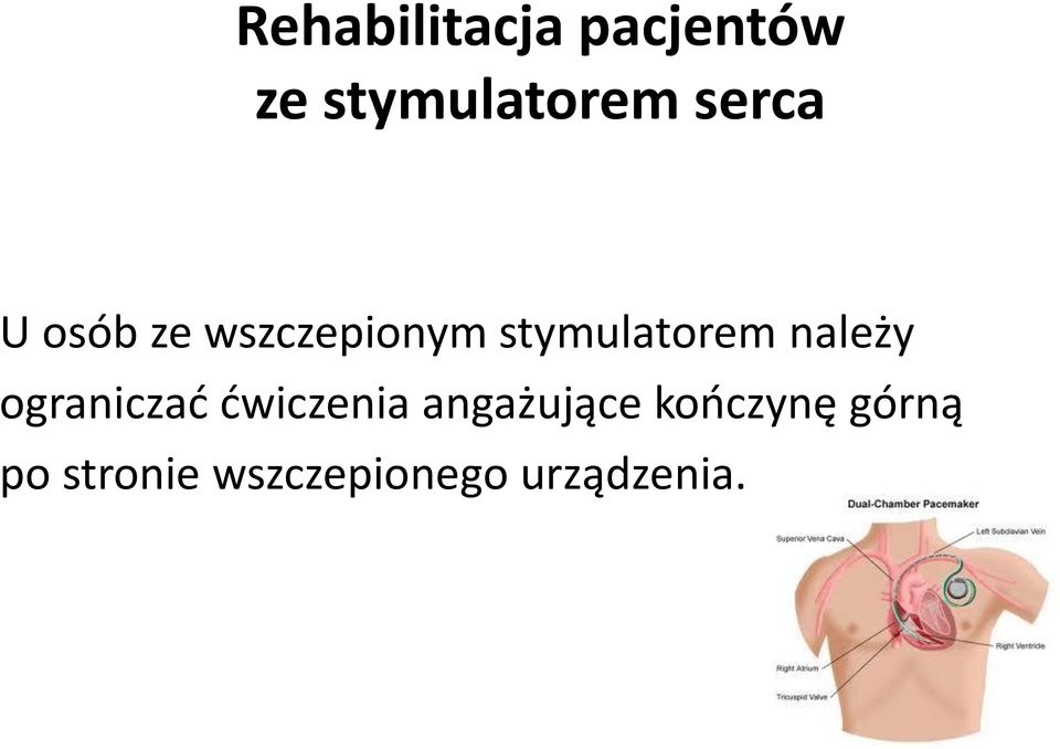 należy ograniczać ćwiczenia angażujące