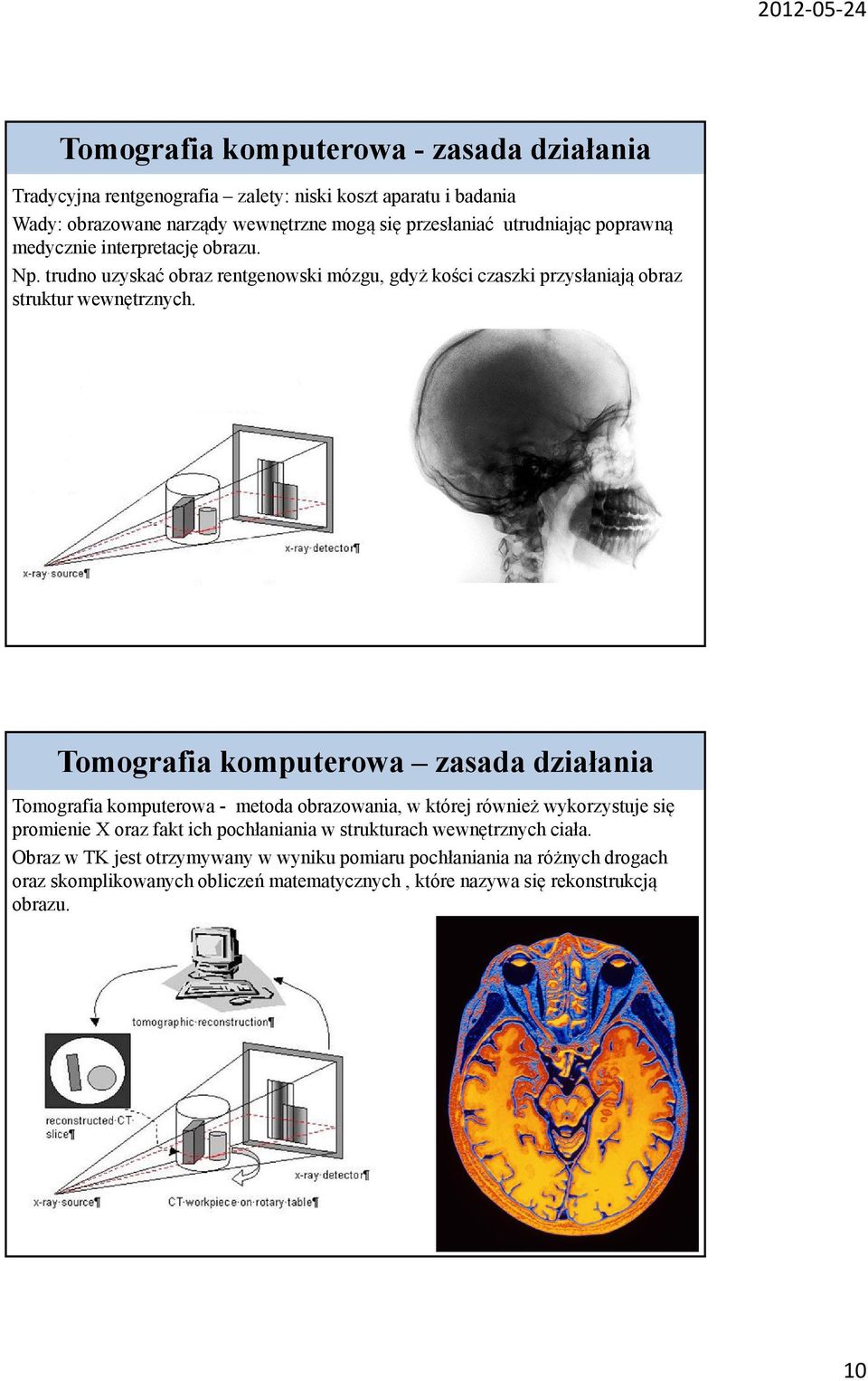 Tomografia komputerowa zasada działania Tomografia komputerowa - metoda obrazowania, w której również wykorzystuje się promienie X oraz fakt ich pochłaniania w