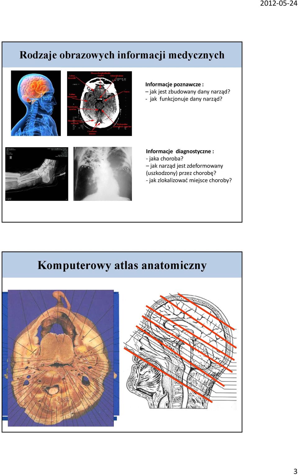 RG Informacje diagnostyczne : jaka choroba?