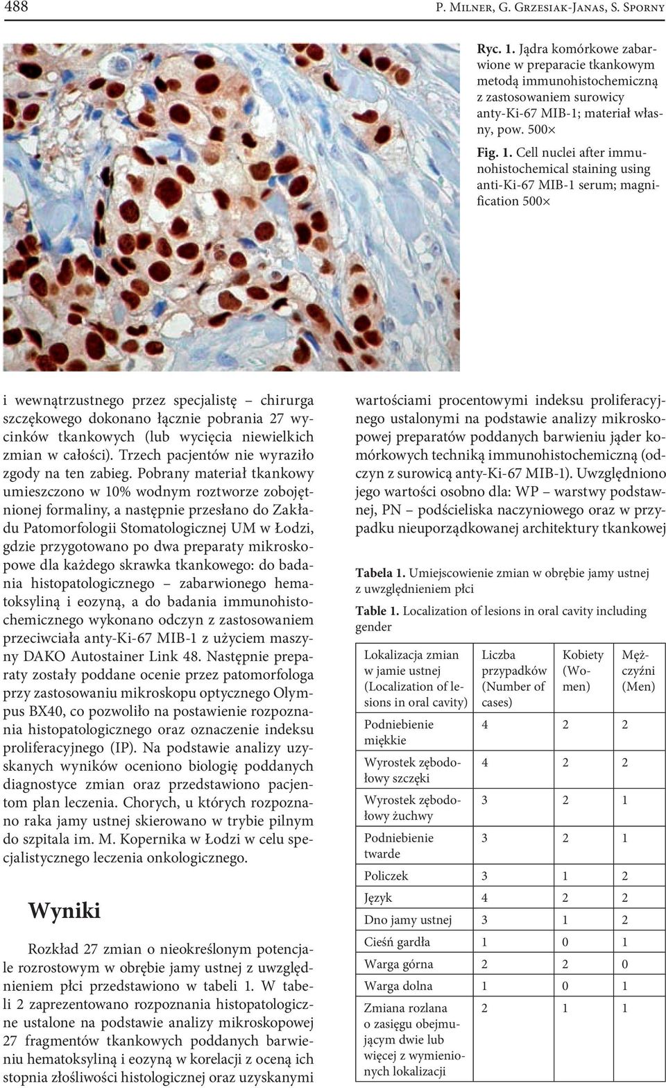 Cell nuclei after immunohistochemical staining using anti-ki-67 MIB-1 serum; magnification 500 i wewnątrzustnego przez specjalistę chirurga szczękowego dokonano łącznie pobrania 27 wycinków