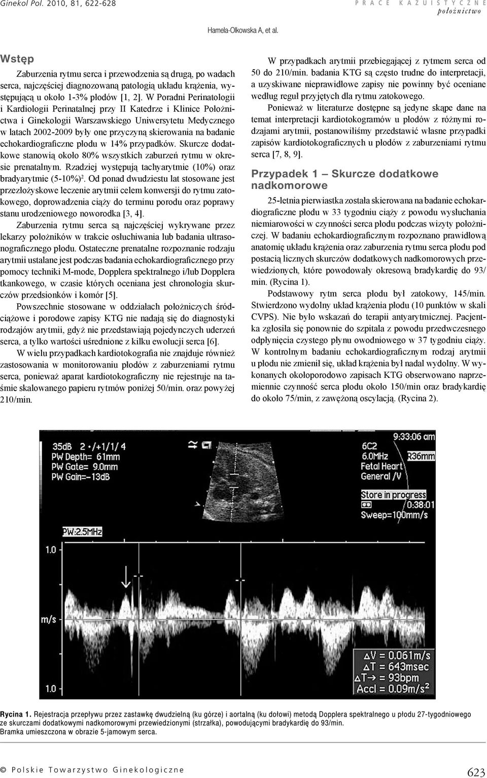 badanie echokardiograficzne płodu w 14% przypadków. Skurcze dodatkowe stanowią około 80% wszystkich zaburzeń rytmu w okresie prenatalnym.