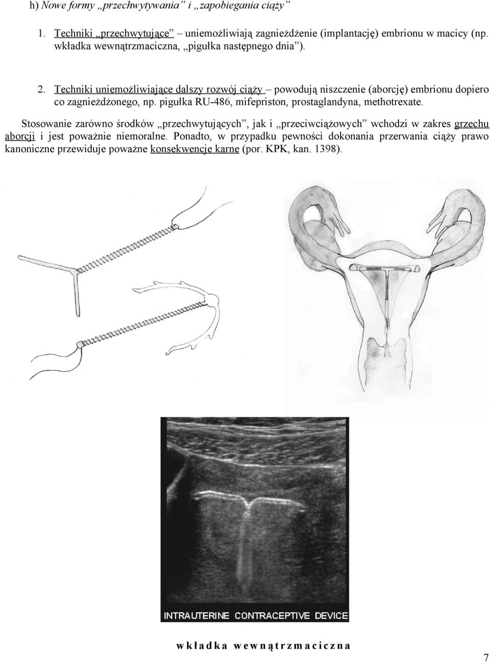 pigułka RU-486, mifepriston, prostaglandyna, methotrexate.