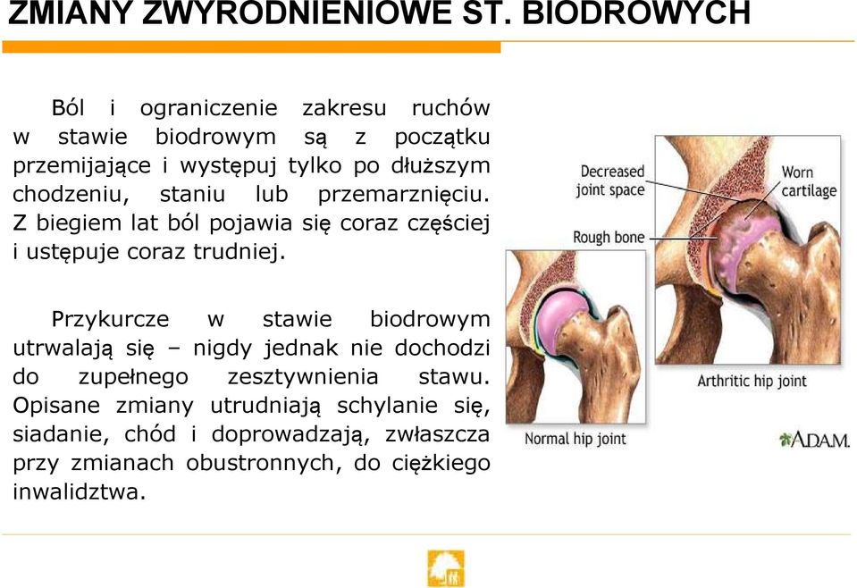 chodzeniu, staniu lub przemarznięciu. Z biegiem lat ból pojawia się coraz częściej i ustępuje coraz trudniej.