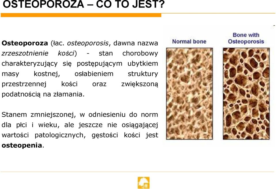 postępującym ubytkiem masy kostnej, osłabieniem struktury przestrzennej kości oraz zwiększoną