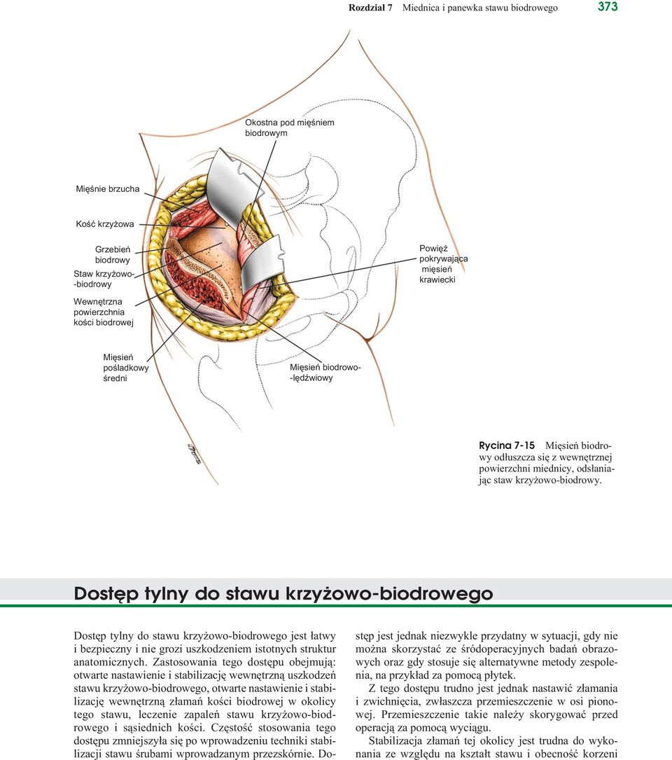 Dostęp tylny do stawu krzyżowo-biodrowego Dostęp tylny do stawu krzyżowo-biodrowego jest łatwy i bezpieczny i nie grozi uszkodzeniem istotnych struktur anatomicznych.