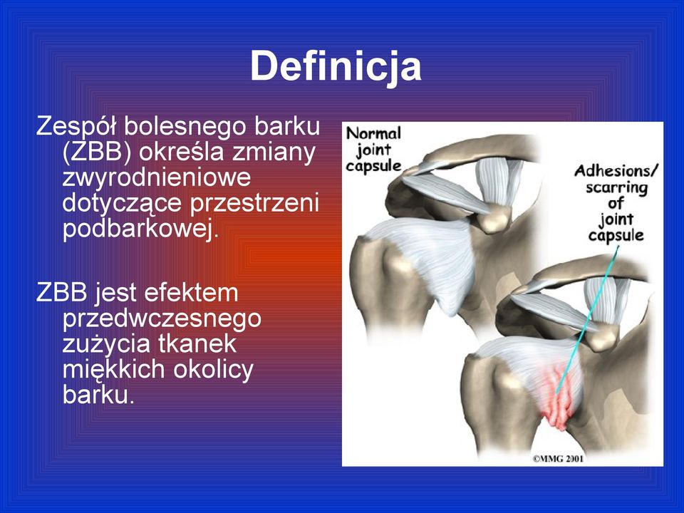 podbarkowej.