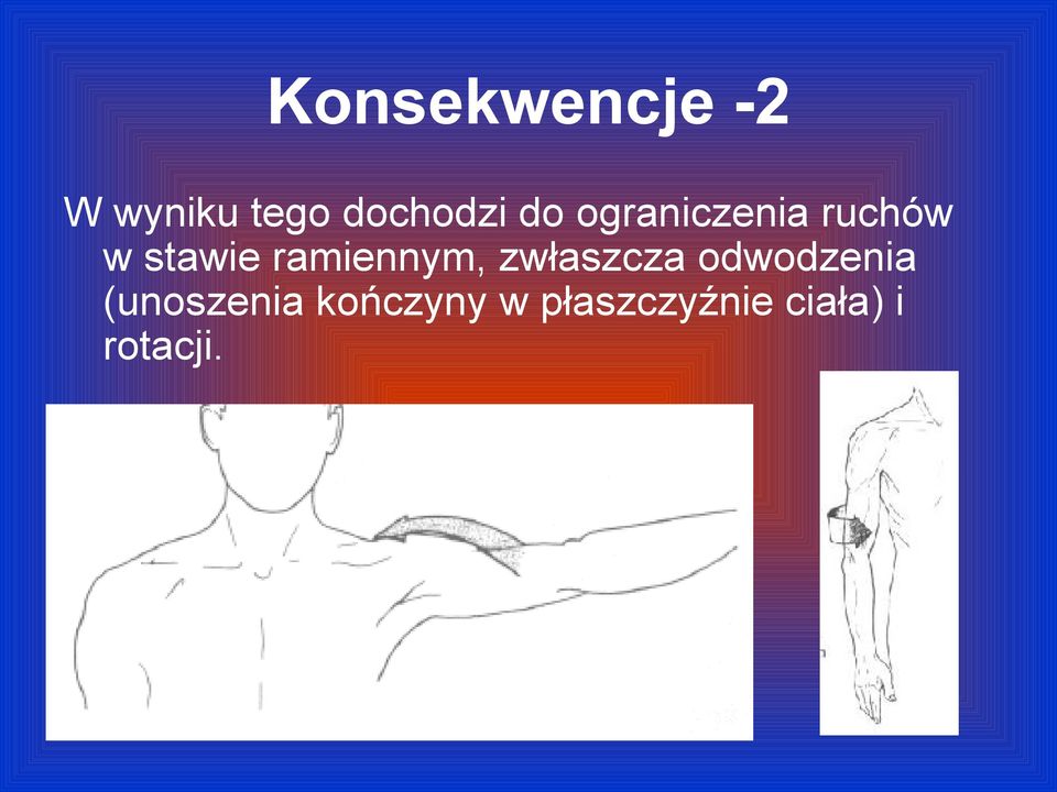 ramiennym, zwłaszcza odwodzenia