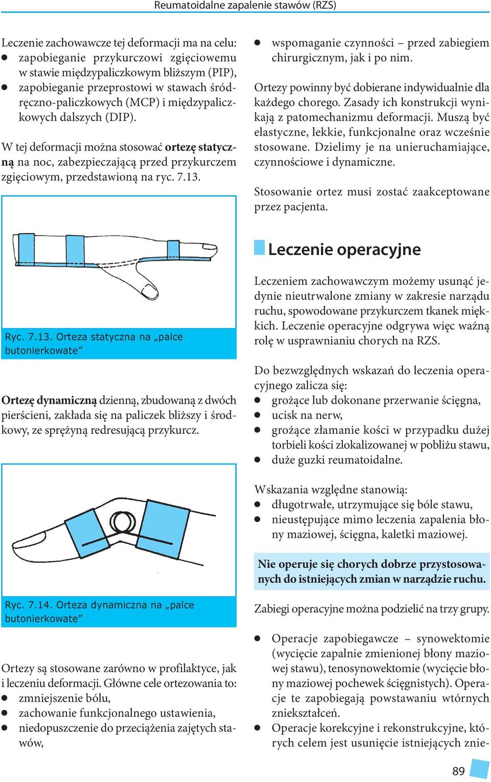 wspomaganie czynności przed zabiegiem chirurgicznym, jak i po nim. Ortezy powinny być dobierane indywiduanie da każdego chorego. Zasady ich konstrukcji wynikają z patomechanizmu deformacji.