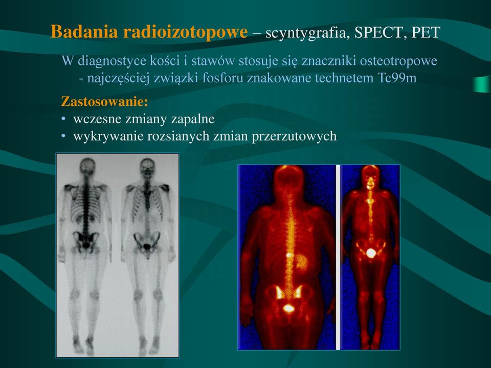 najczęściej związki fosforu znakowane technetem Tc99m