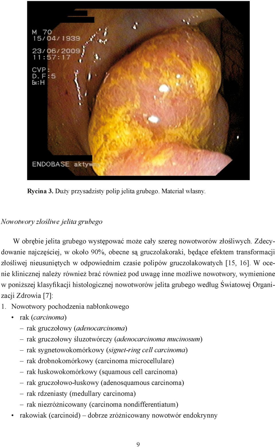 W ocenie klinicznej należy również brać również pod uwagę inne możliwe nowotwory, wymienione w poniższej klasyfikacji histologicznej nowotworów jelita grubego według Światowej Organizacji Zdrowia