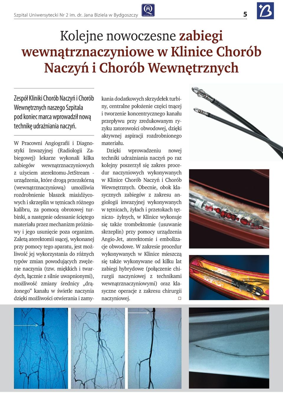 marca wprowadził nową technikę udrażniania naczyń.