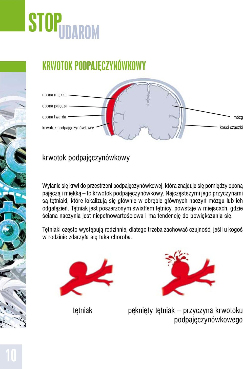 Najczęstszymi jego przyczynami są tętniaki, które lokalizują się głównie w obrębie głównych naczyń mózgu lub ich odgałęzień.