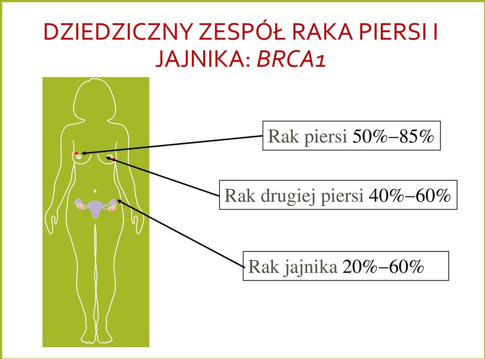 piersi 50%-85% Rak drugiej
