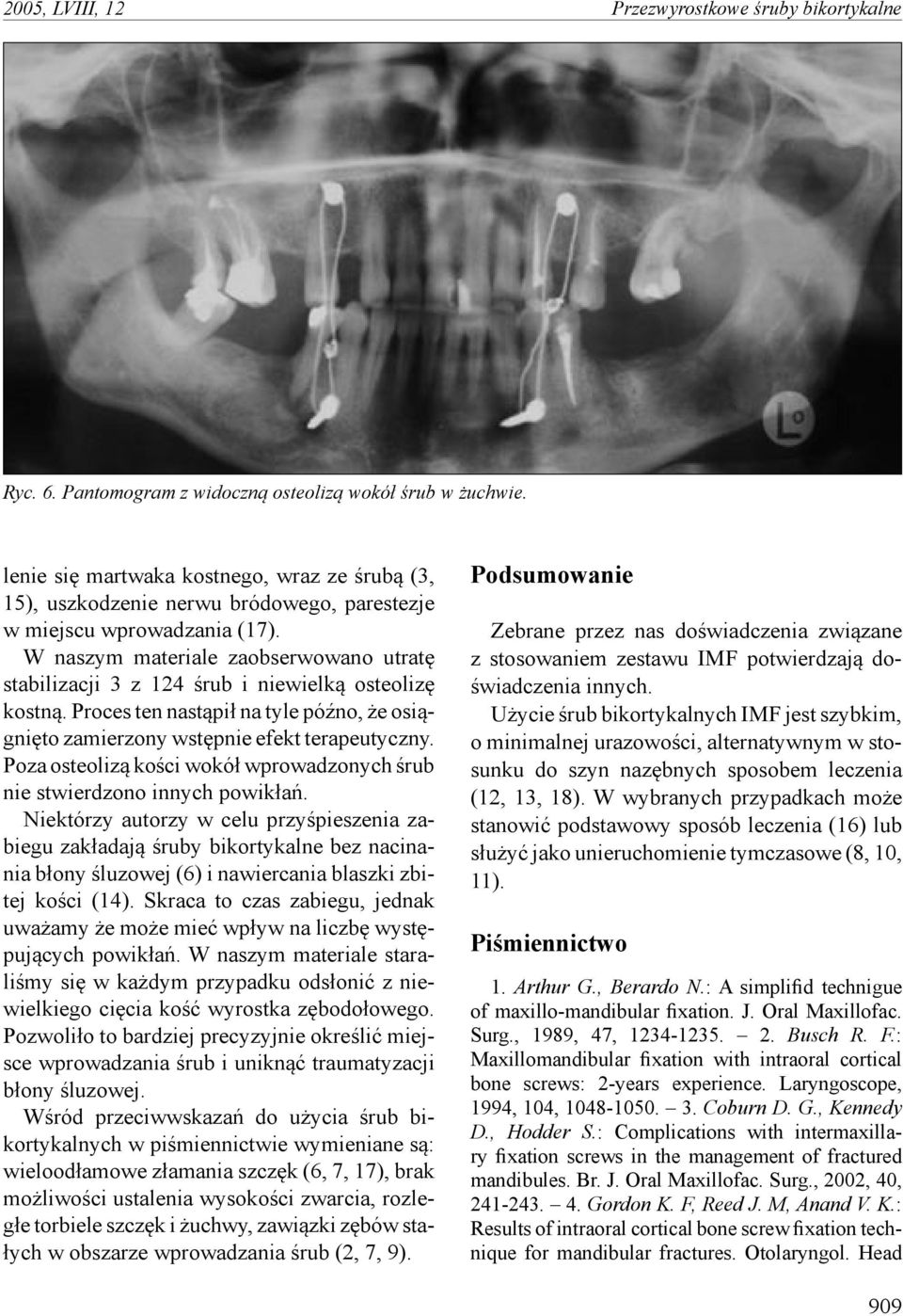 W naszym materiale zaobserwowano utratę stabilizacji 3 z 124 śrub i niewielką osteolizę kostną. Proces ten nastąpił na tyle późno, że osiągnięto zamierzony wstępnie efekt terapeutyczny.