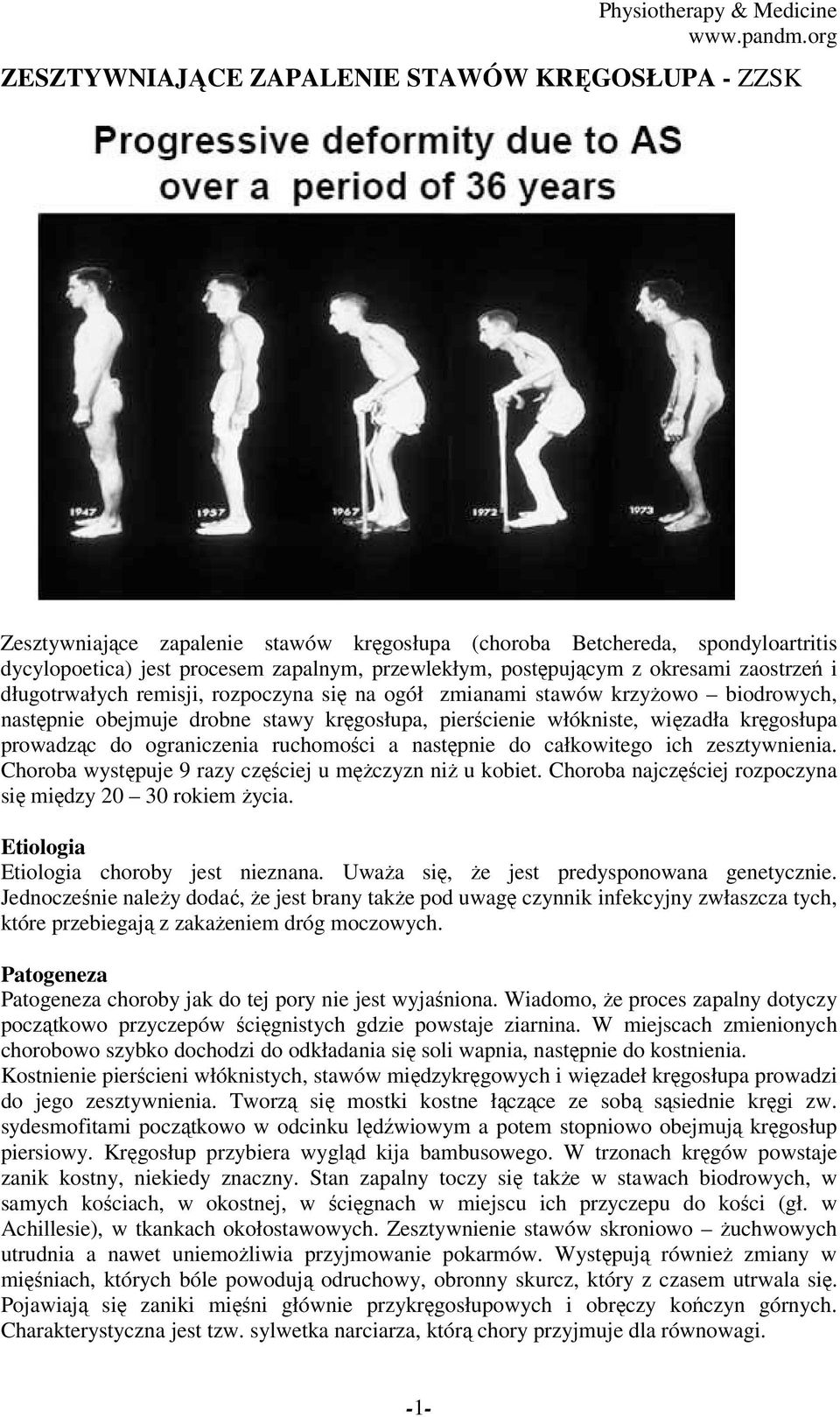 prowadząc do ograniczenia ruchomości a następnie do całkowitego ich zesztywnienia. Choroba występuje 9 razy częściej u mężczyzn niż u kobiet.