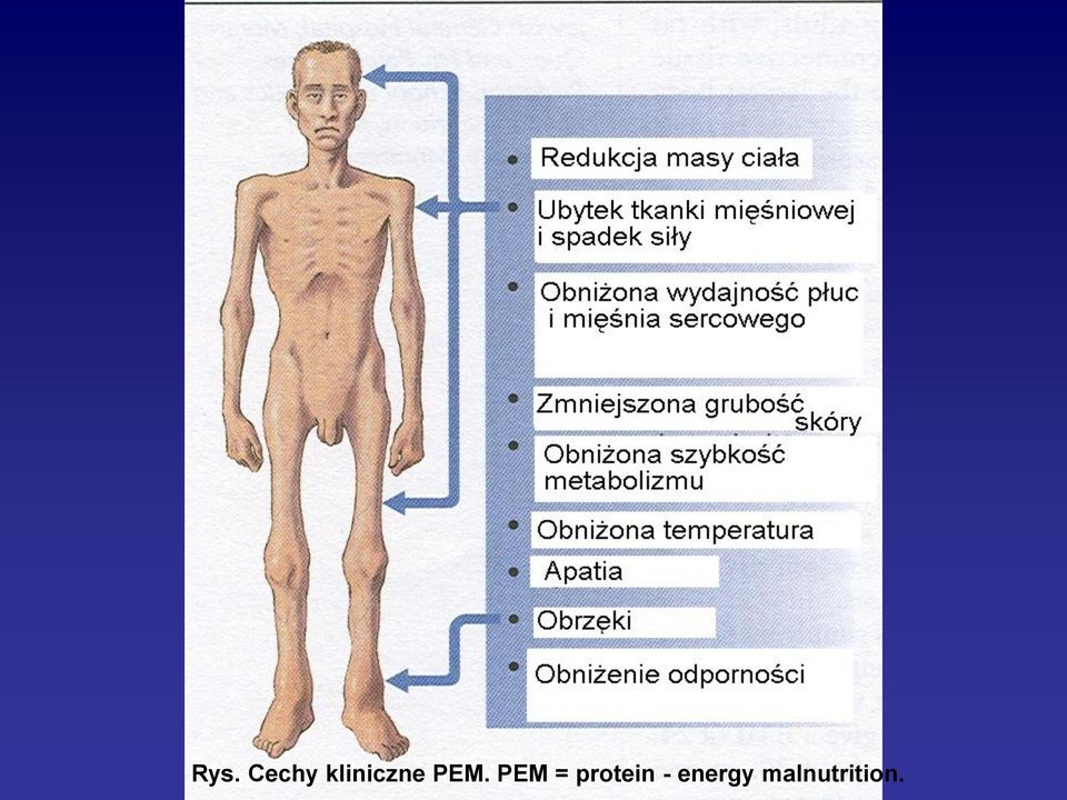 PEM = protein -