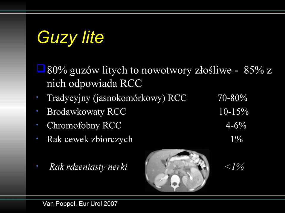 Brodawkowaty RCC Chromofobny RCC Rak cewek zbiorczych Rak