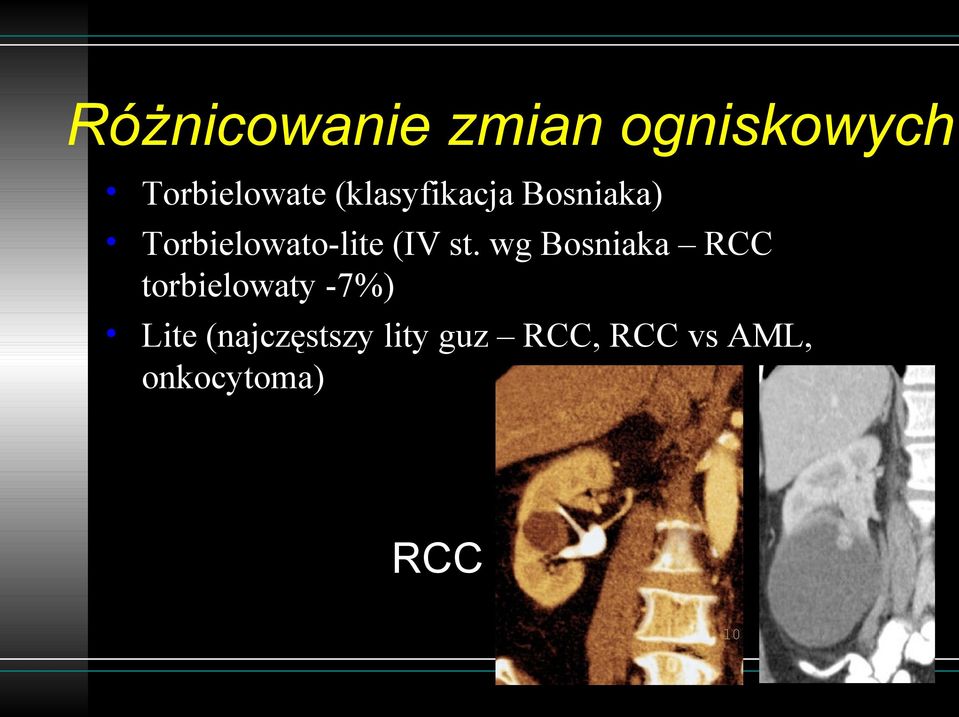 st. wg Bosniaka RCC torbielowaty -7%) Lite