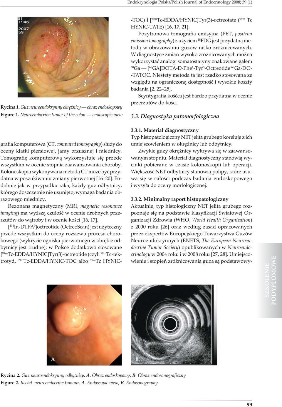 Pozytronowa tomografia emisyjna (PET, positron emission tomography) z użyciem 18 FDG jest przydatną metodą w obrazowaniu guzów nisko zróżnicowanych.