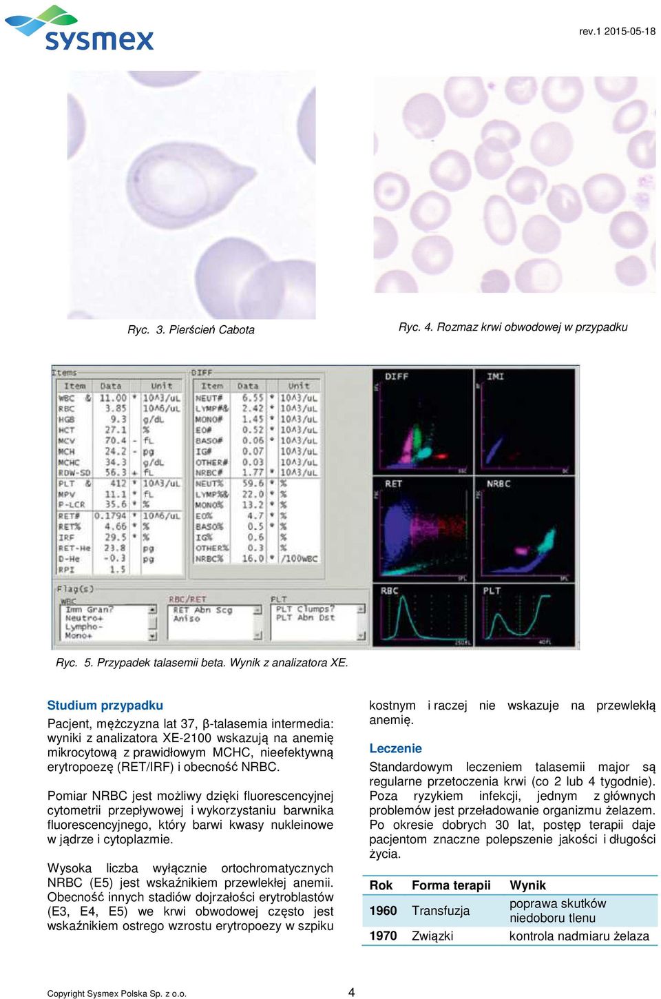 Pomiar NRBC jest możliwy dzięki fluorescencyjnej cytometrii przepływowej i wykorzystaniu barwnika fluorescencyjnego, który barwi kwasy nukleinowe w jądrze i cytoplazmie.