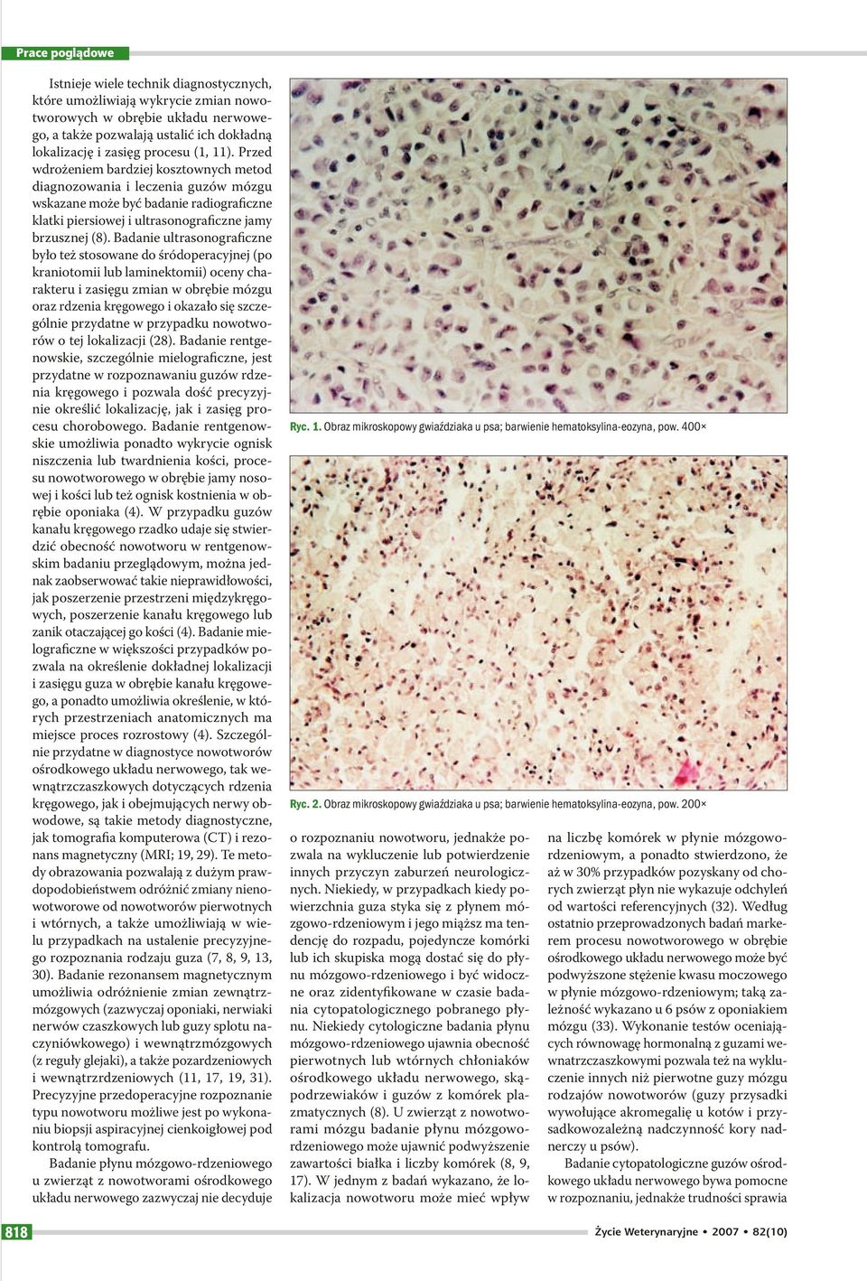 Badanie ultrasonograficzne było też stosowane do śródoperacyjnej (po kraniotomii lub laminektomii) oceny charakteru i zasięgu zmian w obrębie mózgu oraz rdzenia kręgowego i okazało się szczególnie