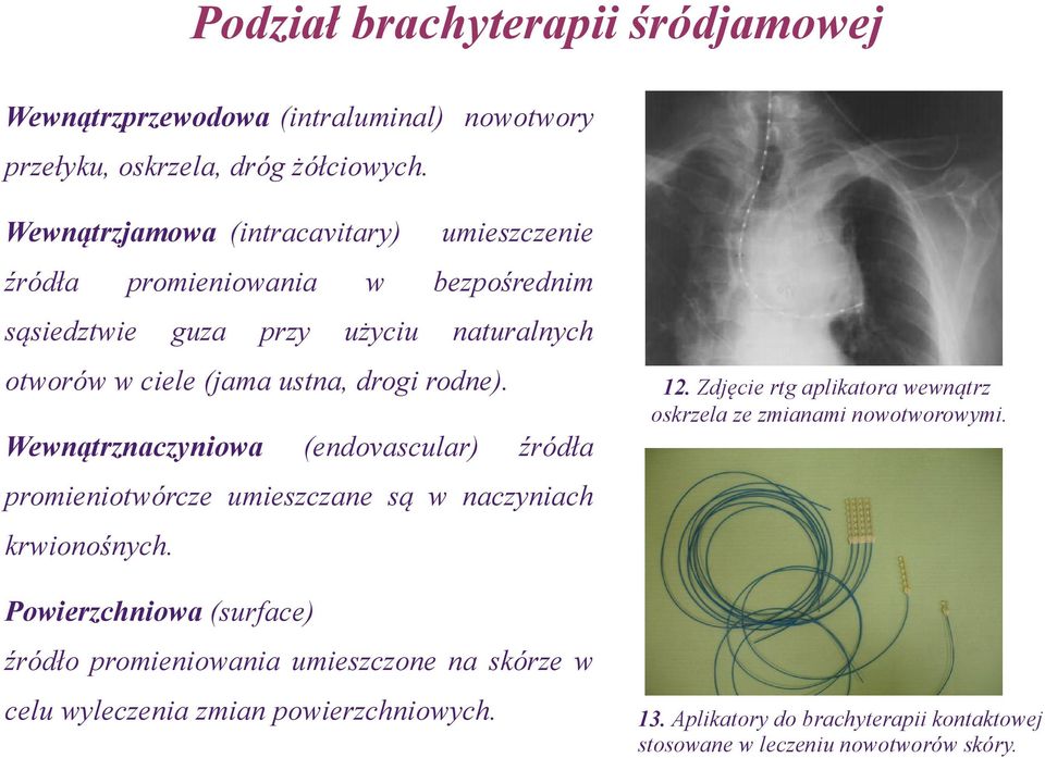 rodne). Wewnątrznaczyniowa (endovascular) 12. Zdjęcie rtg aplikatora wewnątrz oskrzela ze zmianami nowotworowymi.