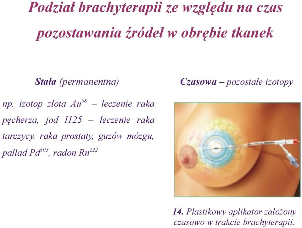 izotop złota Au98 leczenie raka pęcherza, jod I125 leczenie raka tarczycy, raka