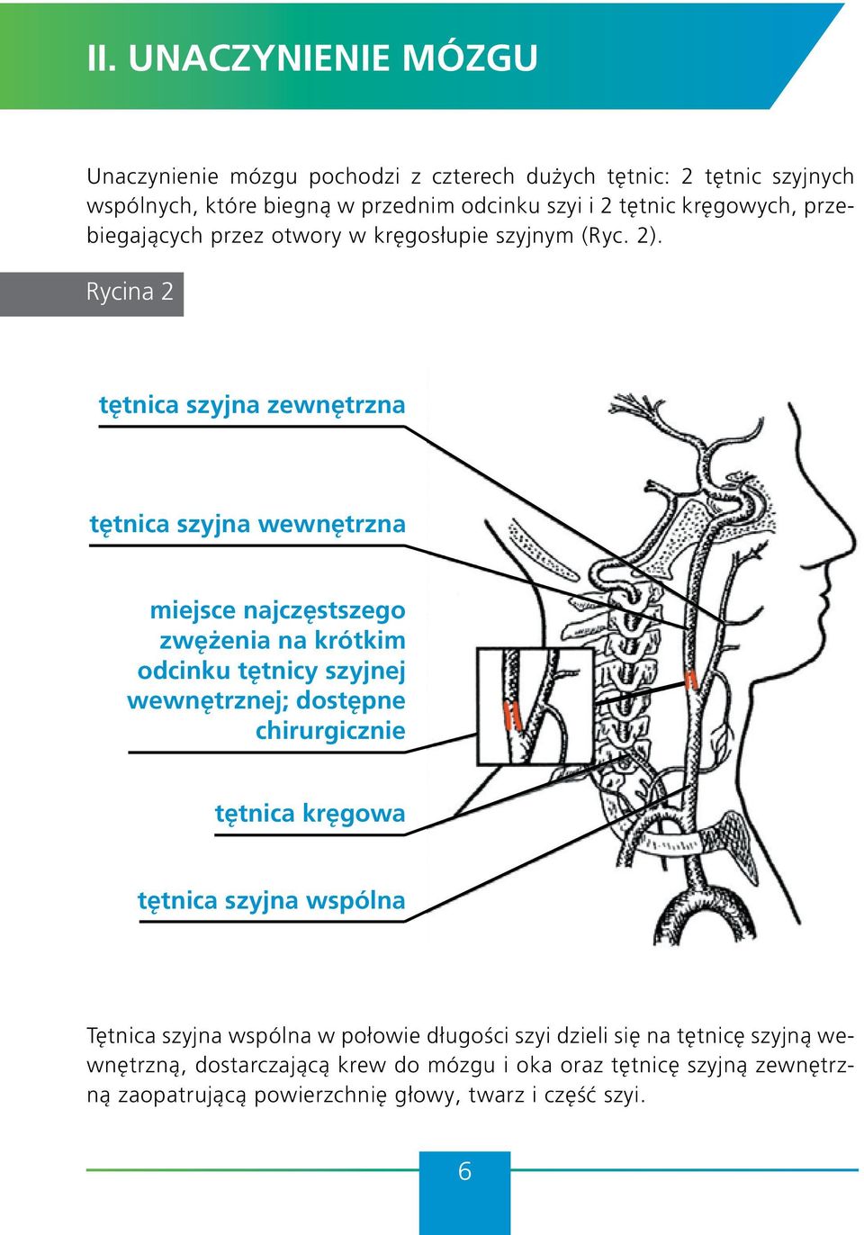 Rycina 2 tętnica szyjna zewnętrzna tętnica szyjna wewnętrzna miejsce najczęstszego zwężenia na krótkim odcinku tętnicy szyjnej wewnętrznej; dostępne