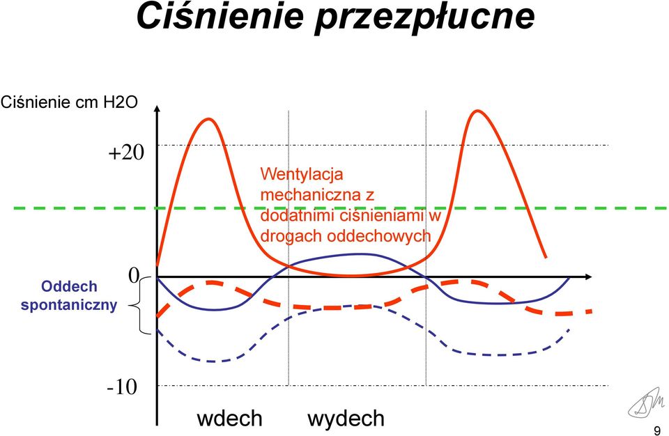 dodatnimi ciśnieniami w drogach