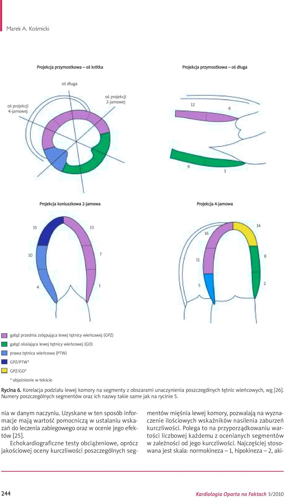 10 7 11 8 4 1 5 2 gałąź przednia zstępująca lewej tętnicy wieńcowej (GPZ) gałąź okalająca lewej tętnicy wieńcowej (GO) prawa tętnica wieńcowa (PTW) GPZ/PTW* GPZ/GO* * objaśnienie w tekście Rycina 6.