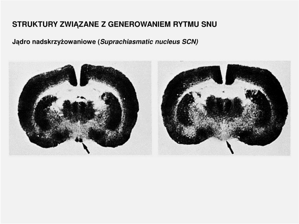 Jądro nadskrzyżowaniowe