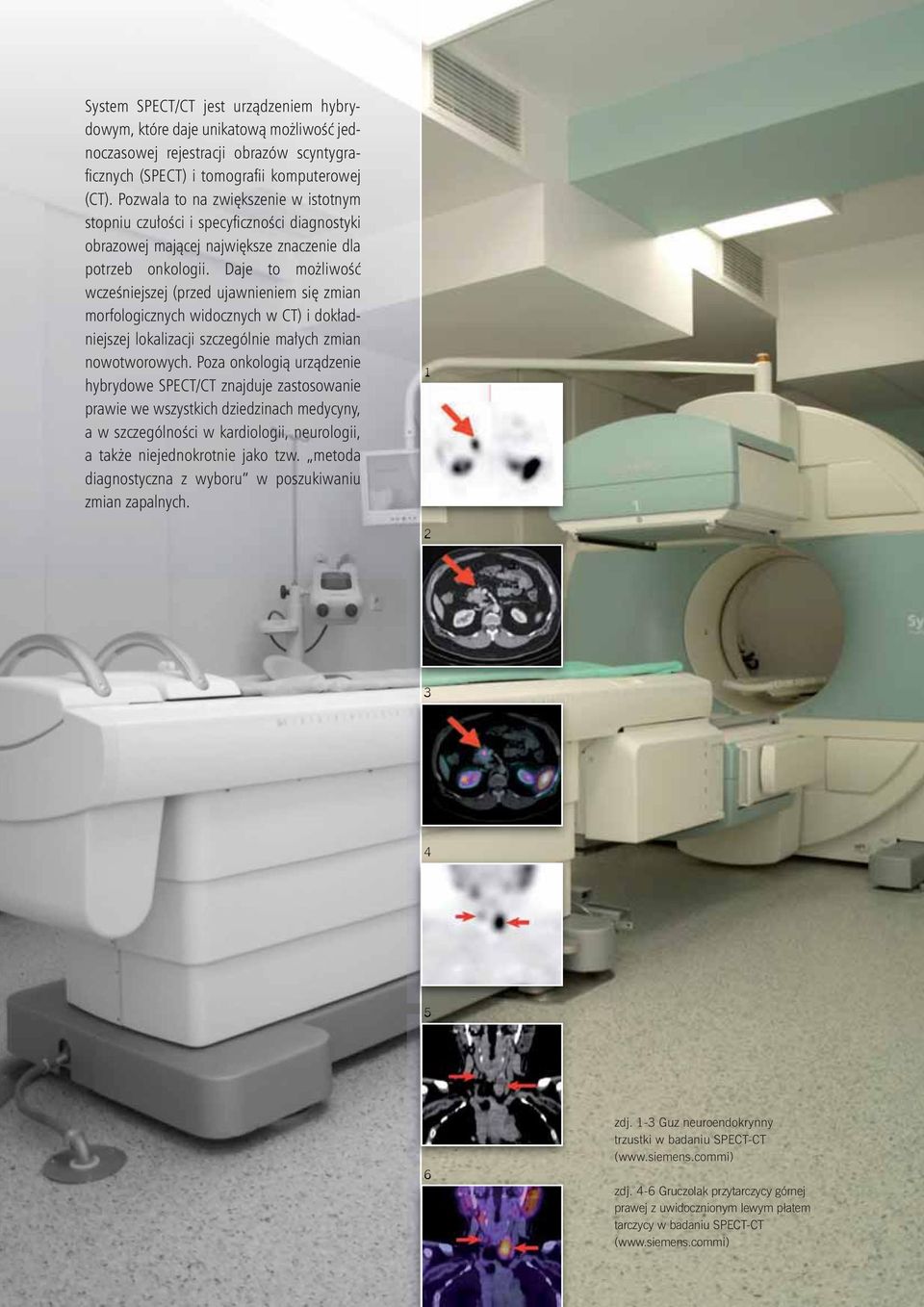 Daje to możliwość wcześniejszej (przed ujawnieniem się zmian morfologicznych widocznych w CT) i dokładniejszej lokalizacji szczególnie małych zmian nowotworowych.